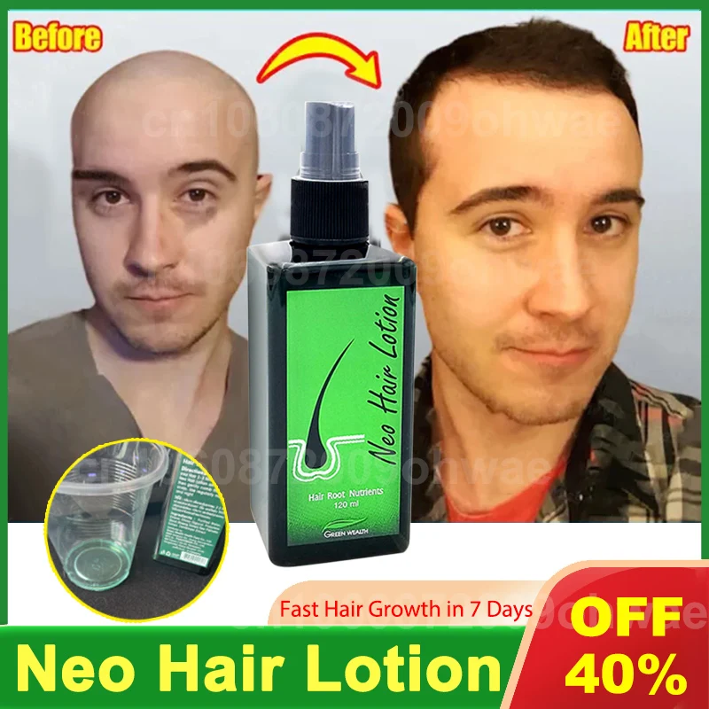 

Neo Hair Lotion orginal Paradise thailand Hair Growth Oil Fast Effective Baldness Repair Hereditary Hair Green Wealth For Man