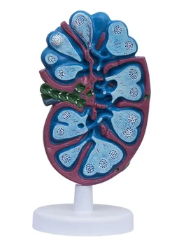 Enlarged Lymph Node Model 1