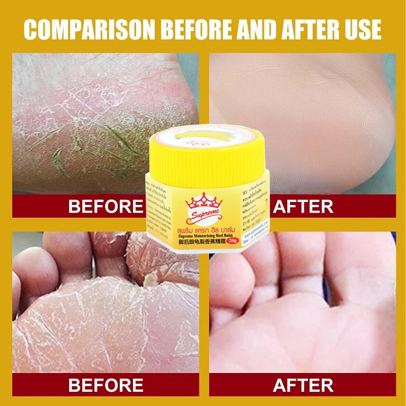 

Chinese Medicinal Ointment Hand Foot Crack Cream Heel Chapped Peeling Repair Frostbite Anti Dry Crack Skin Creams Wholesale