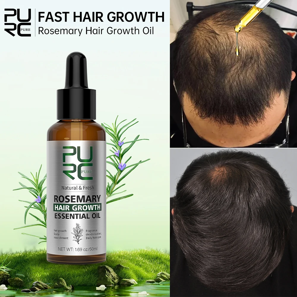 PURC-Rosemary-Oil-for-Hair-Growth-Products-Hair-Loss-Treatment-Ginger ... - Fast Hair Growth For Men