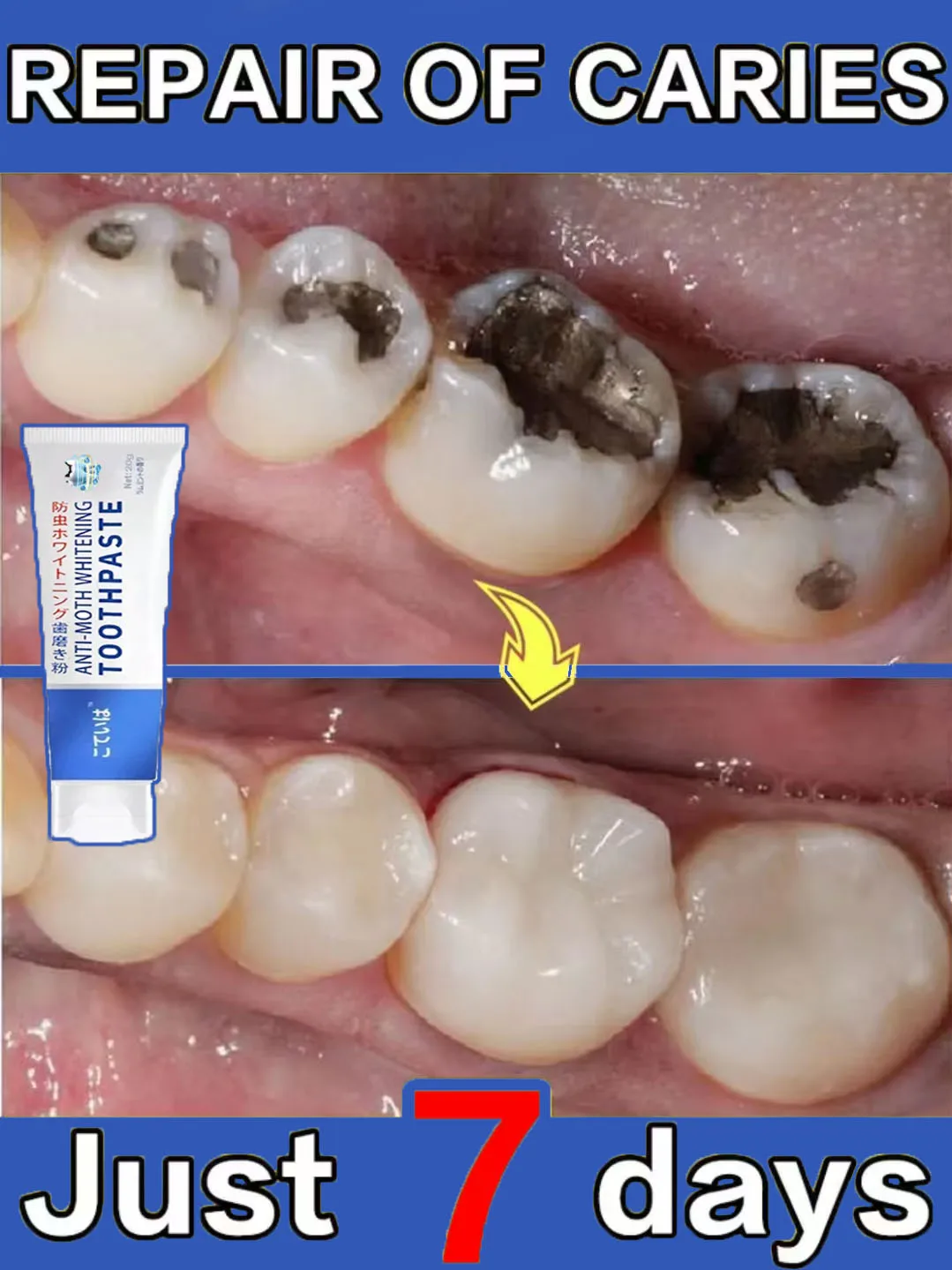 Fra&icirc;cheur de la bouche odeur respiratoire parodontite pr&eacute;vention produits de soins buccodentaires dentaires