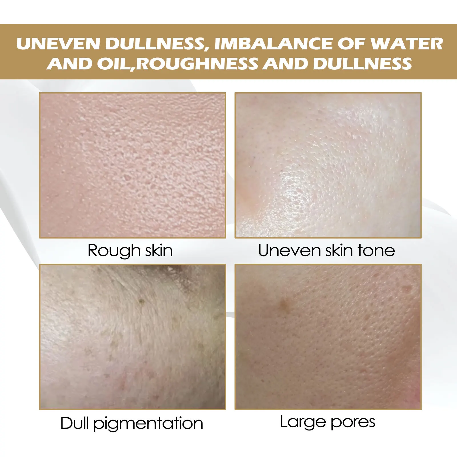 Rice Face Toner Anti Acne Dark Spot Remover Smooth Pore Oil Control Repair Rough Glow Rejuvenating Nourish Pore Shrinking Serum_voghion.com