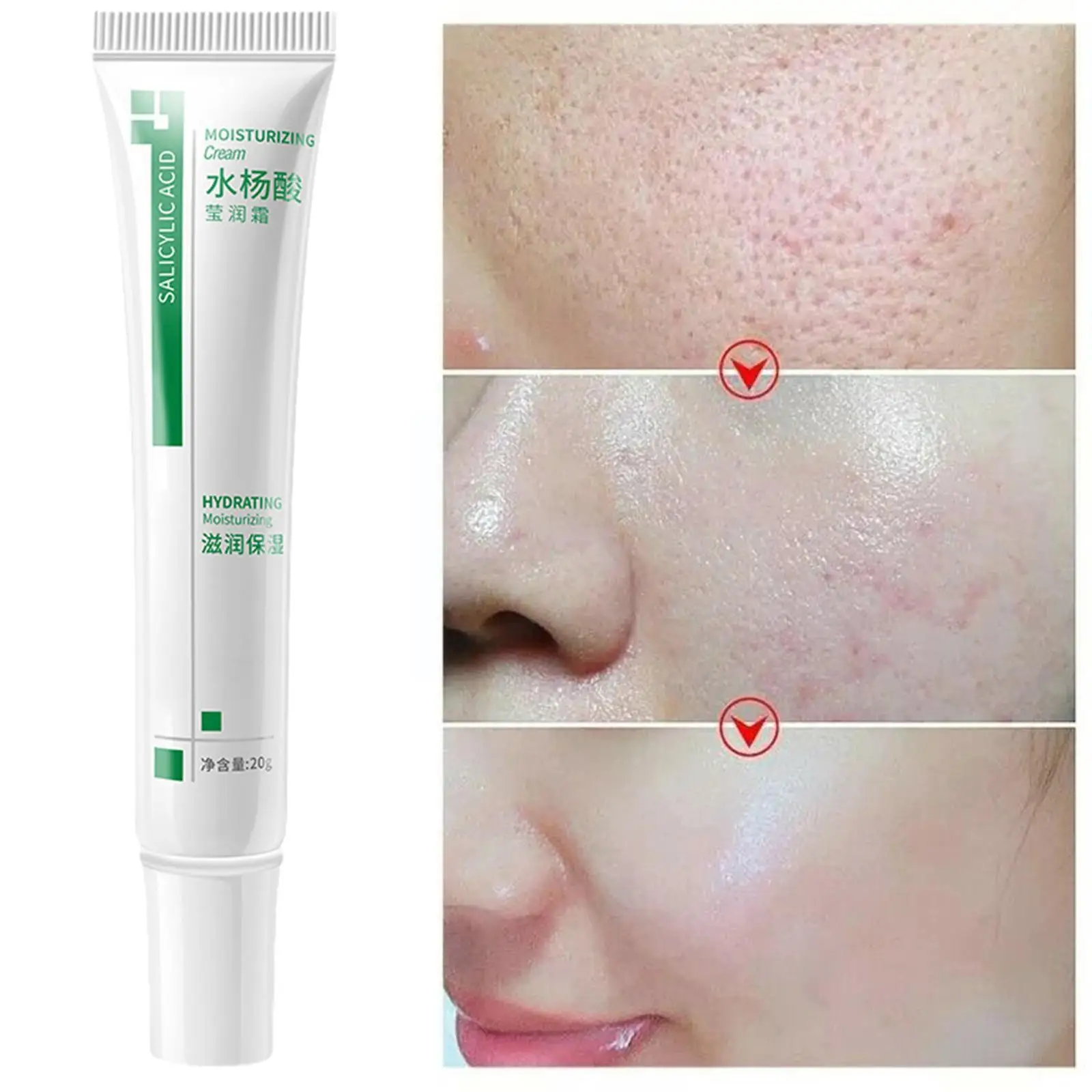 Salicylic Acid Shrink Pores Face Cream Acne Treatment Blackheads Cosmetics Korean Oil Control Moisturizing Remove Whit F7E6