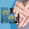 Nail Fungus Treatment Serum Ginger Anti-infective Paronychia Repair Fungal Onychomycosis Nail Toe Care Hand Foot Foot Gel L9A0