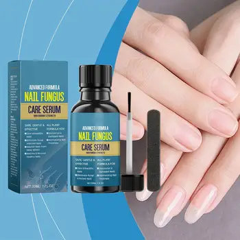 Nail Fungus Treatment Serum Ginger Anti-infective Paronychia Repair Fungal Onychomycosis Nail Toe Care Hand Foot Foot Gel L9A0