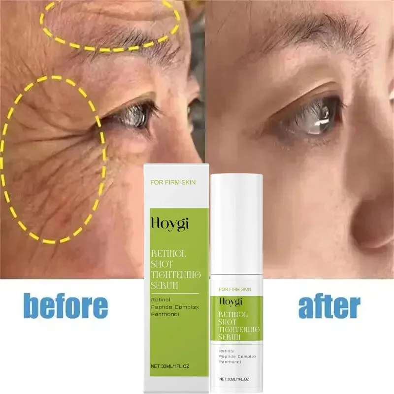 Removal Wrinkle Serum Anti Aging Firming Fade Fine Lines Face Essence Shrink Pores Remove black spots Whitening Beauty Health