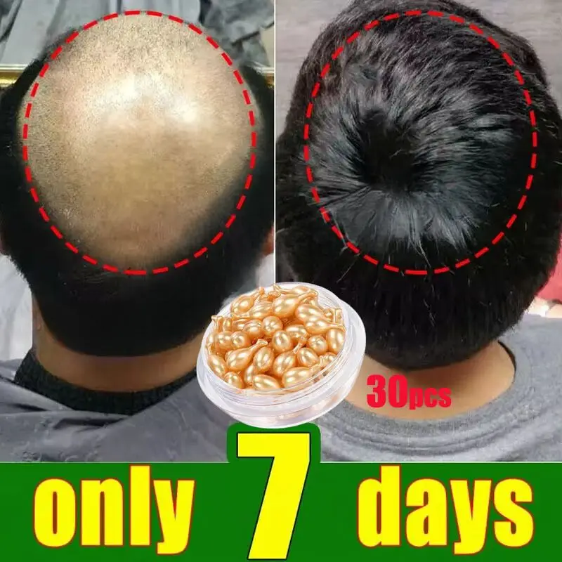 Hair Care Products Hair Growth Serum Anti Hair loss Treatment for Women Men