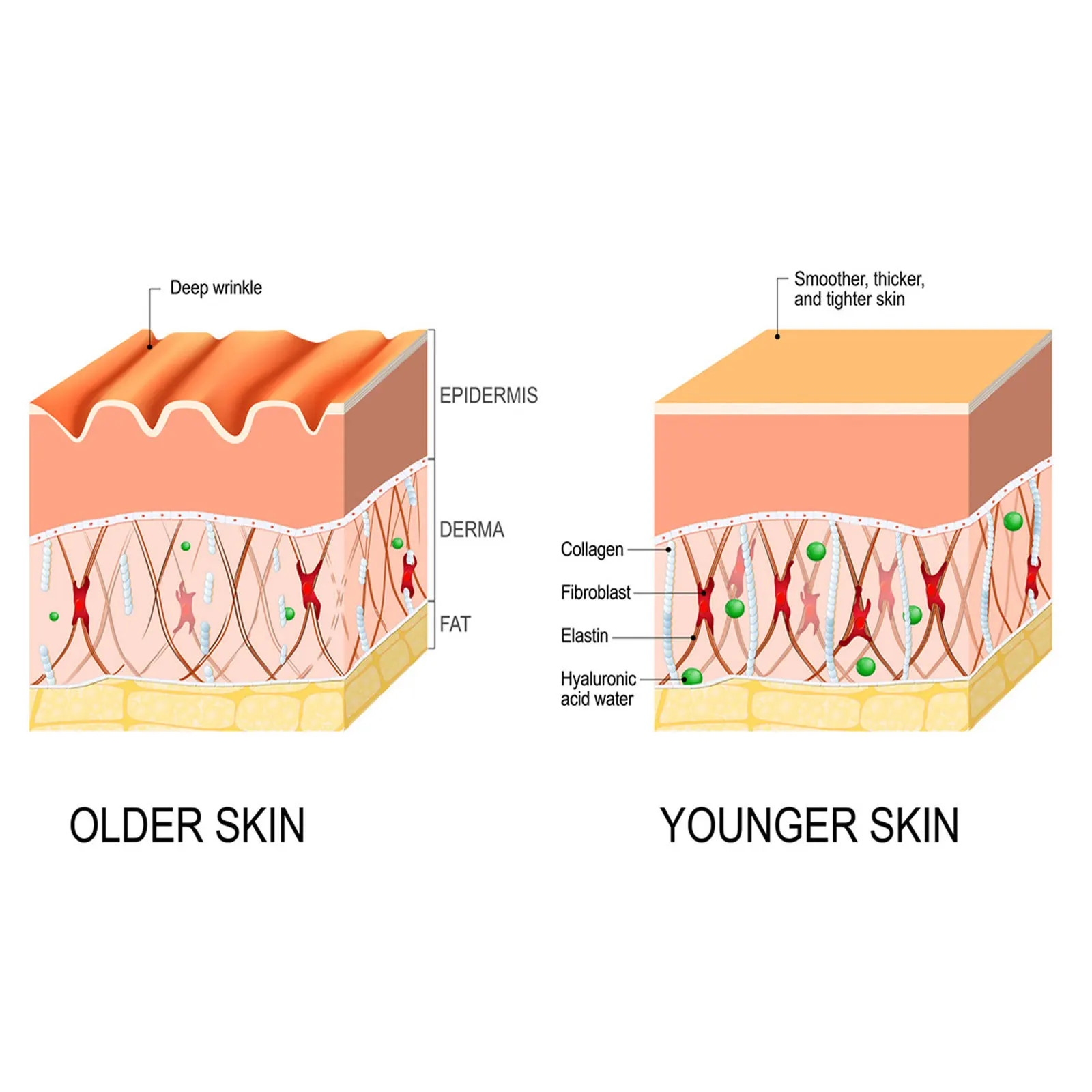 Anti-Falten-Serum, Anti-Aging, Entfernung von Augenringen, Stirnfalten, Gesichtspflege, Zornesfalten, Reparatur von Gesichtsessenz, 30 ml, weiblich_voghion.com