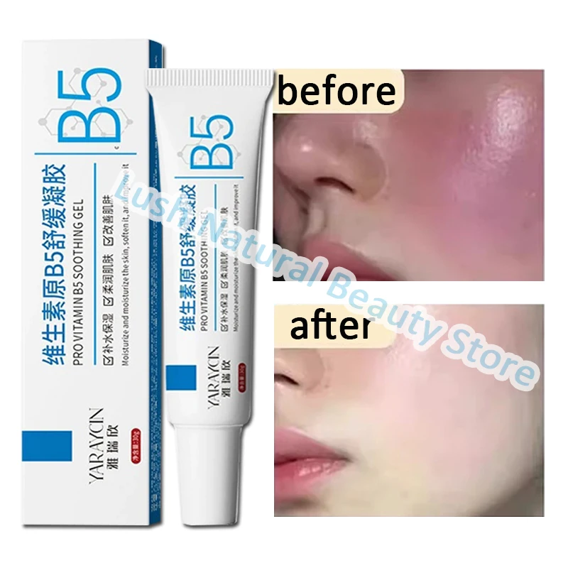 كريم إصلاح احمرار الوجه تحسين جفاف البشرة الحساسة...