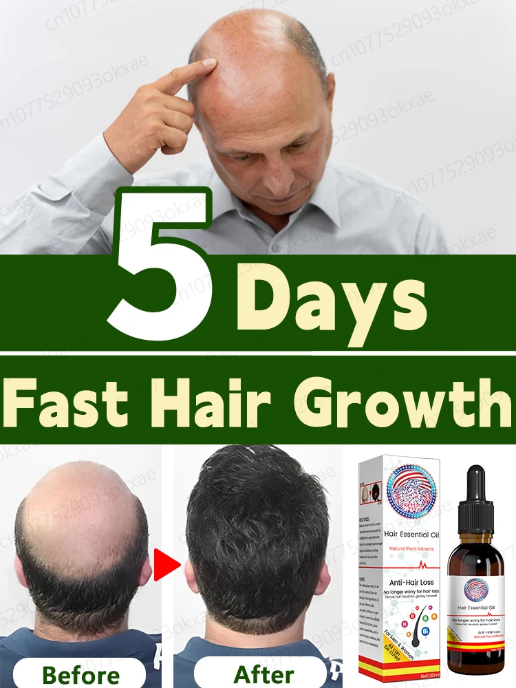 HairGrowthOilFastHairGrowthEffectiveBaldnessRepairHereditary