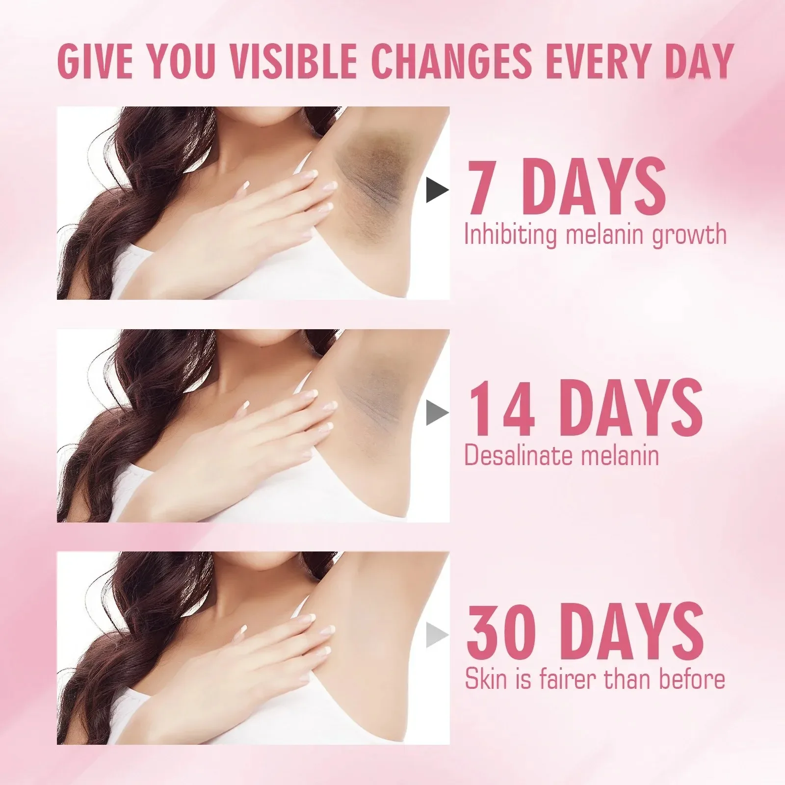 Körper-Bleaching-Creme, erhellt dunkle intime Intimbereiche, Knie, Oberschenkel, inneres Gelenk, Bikini, entfernt Melanin, Achsel-Bleaching-Creme_voghion.com