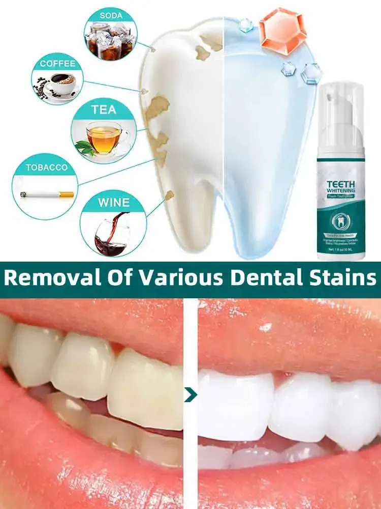 Tooth decay repair teeth health product Repair all tooth decay cavities and protect teeth Removal of Plaque Stains Decay Repair Teeth Whitening