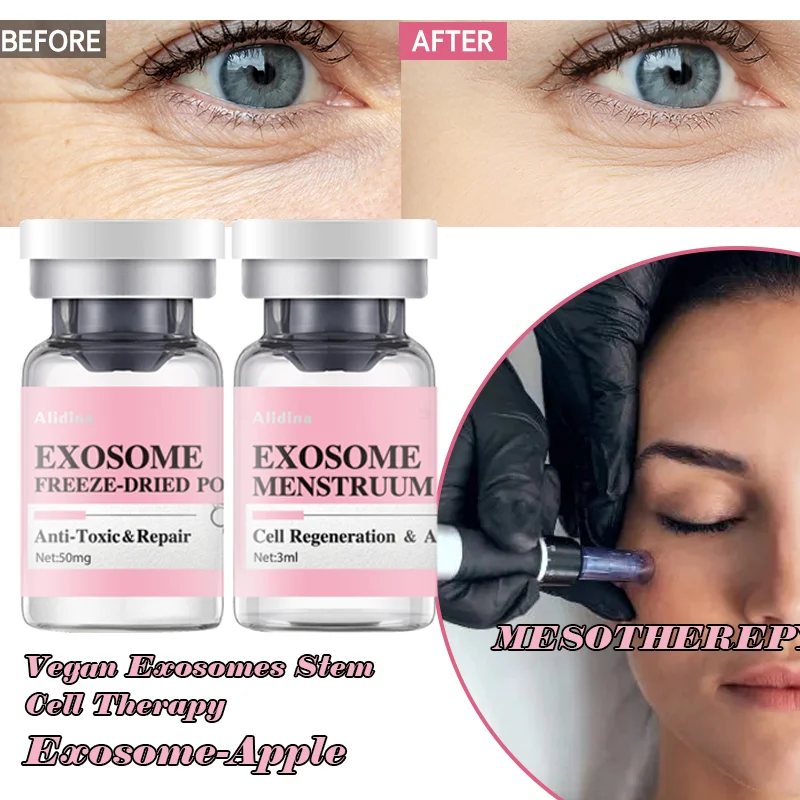 ZS 2box Newest Plant/Animal Stem Cells Anti-aging Serum Youth-boosting Repairing Anti-Wrinkle Freeze-dried Powder Acne Scar Heal