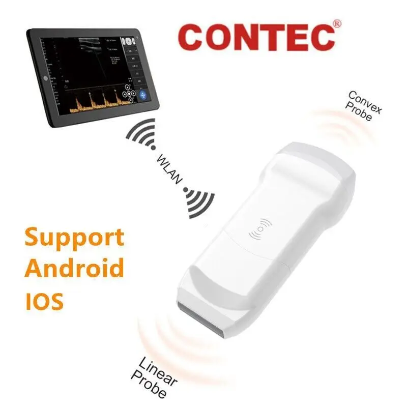 CONTEC CMS1600A Wifi беспроводной