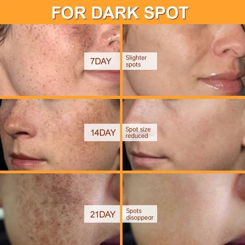 Facial Serum Vitamin C Whitening Effective Remove Dark Spots Freckles Fade Melanin Anti-Wrinkle Brightening Nourishing Face Skin Care