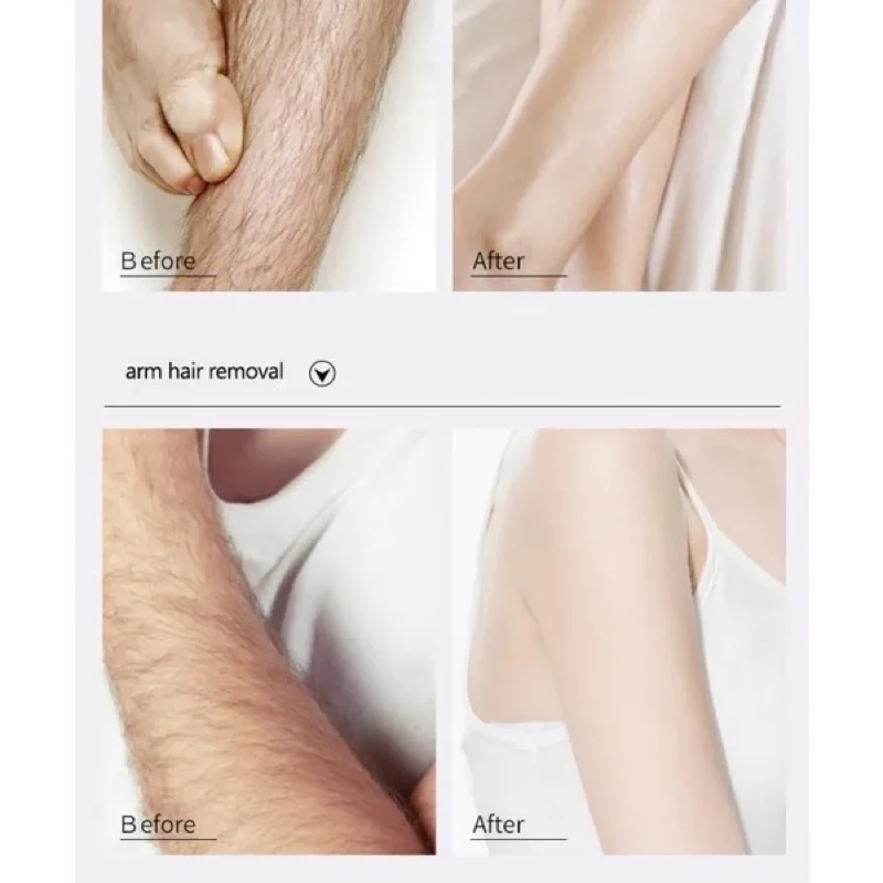 Рисунок 5 - Спрей для быстрого удаления волос в подмышках для ног