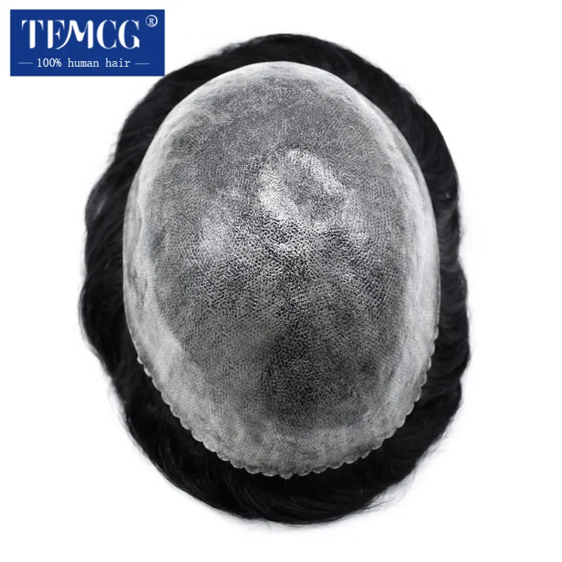 Exclusively available in Brazil Male Hair Prosthesis 0.12mm Injection Skin The remaining amount is need to additional payment 6