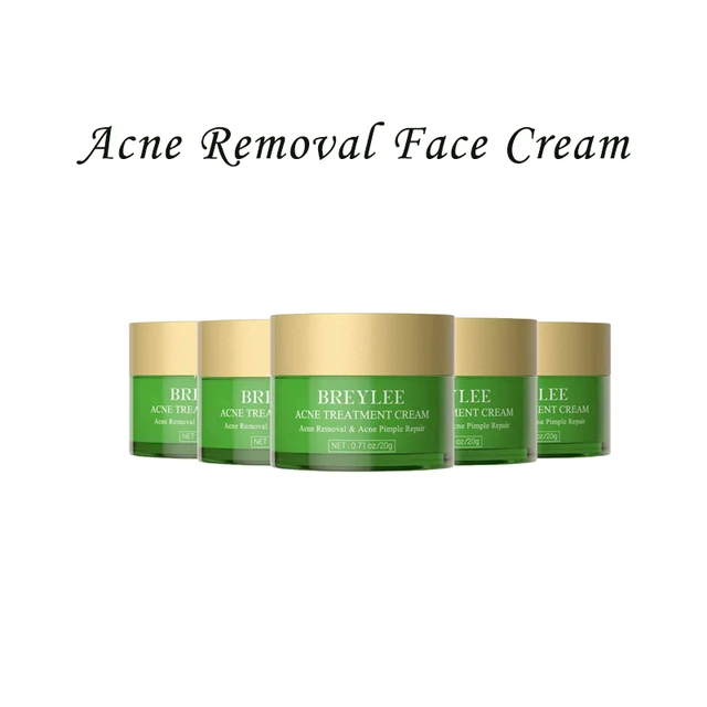 acne cream