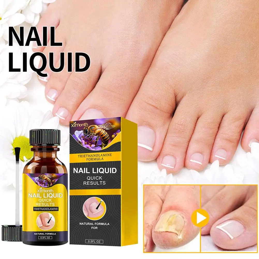 

Nail Liquid Repair Essence Healthy Nails Care Oil 15ml Softening Toenail Or Fingernail Fix & Renew Damage Nail Fungus Treatment