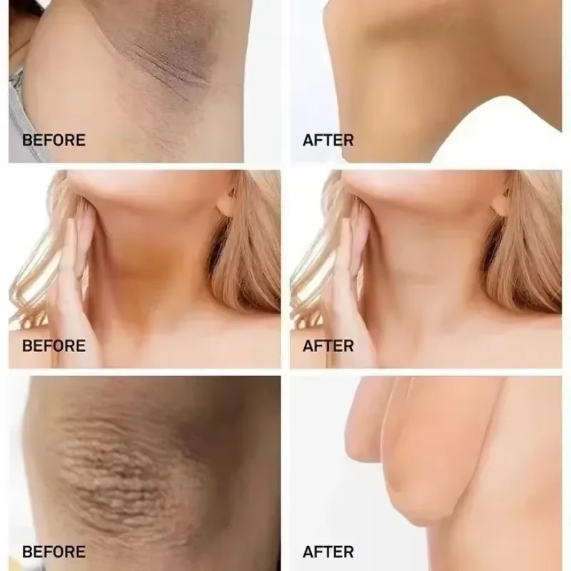 Body Whitening Cream Underarm Knee Buttocks Private Parts Bleach Inner Thighs Intimate Area Remove Melanin Brighten Skin Care 3
