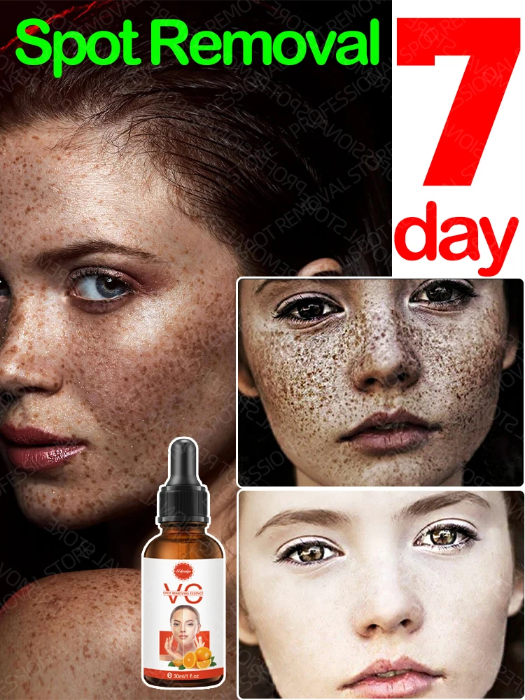 Body Dark Spot Remover Skin Spot Whitening Remove Facial Dark Spots