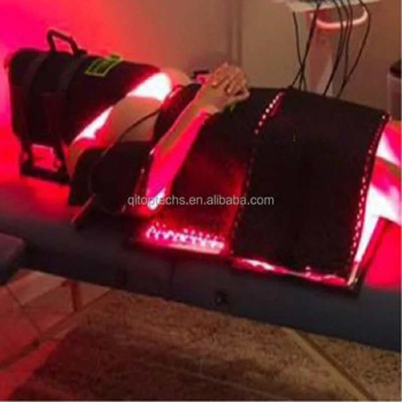 lipolysis laser