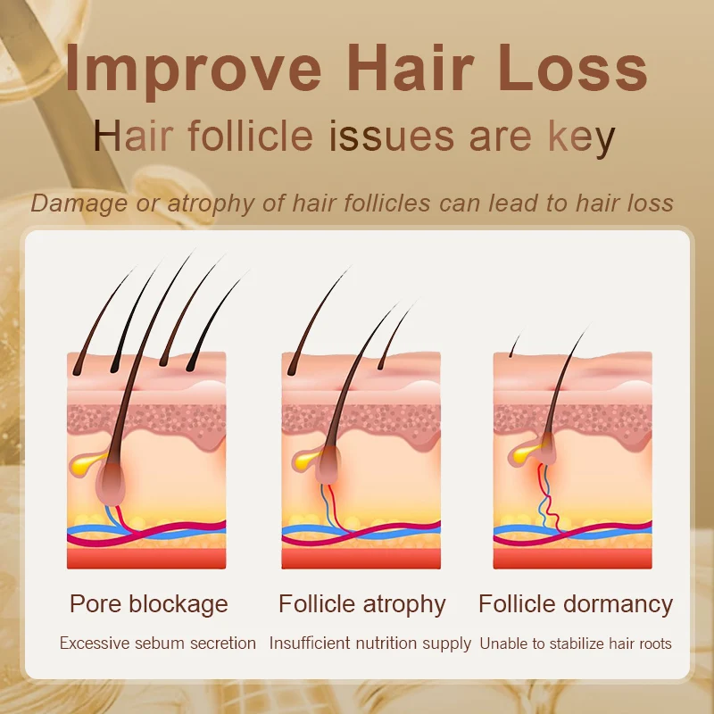 Zhangguang 101 Hair follicle nourishing tonic hair growth serum hair growth cream hair growth spray hair growth shampoo set Hair Regain Tonic Beard growth hair loss product