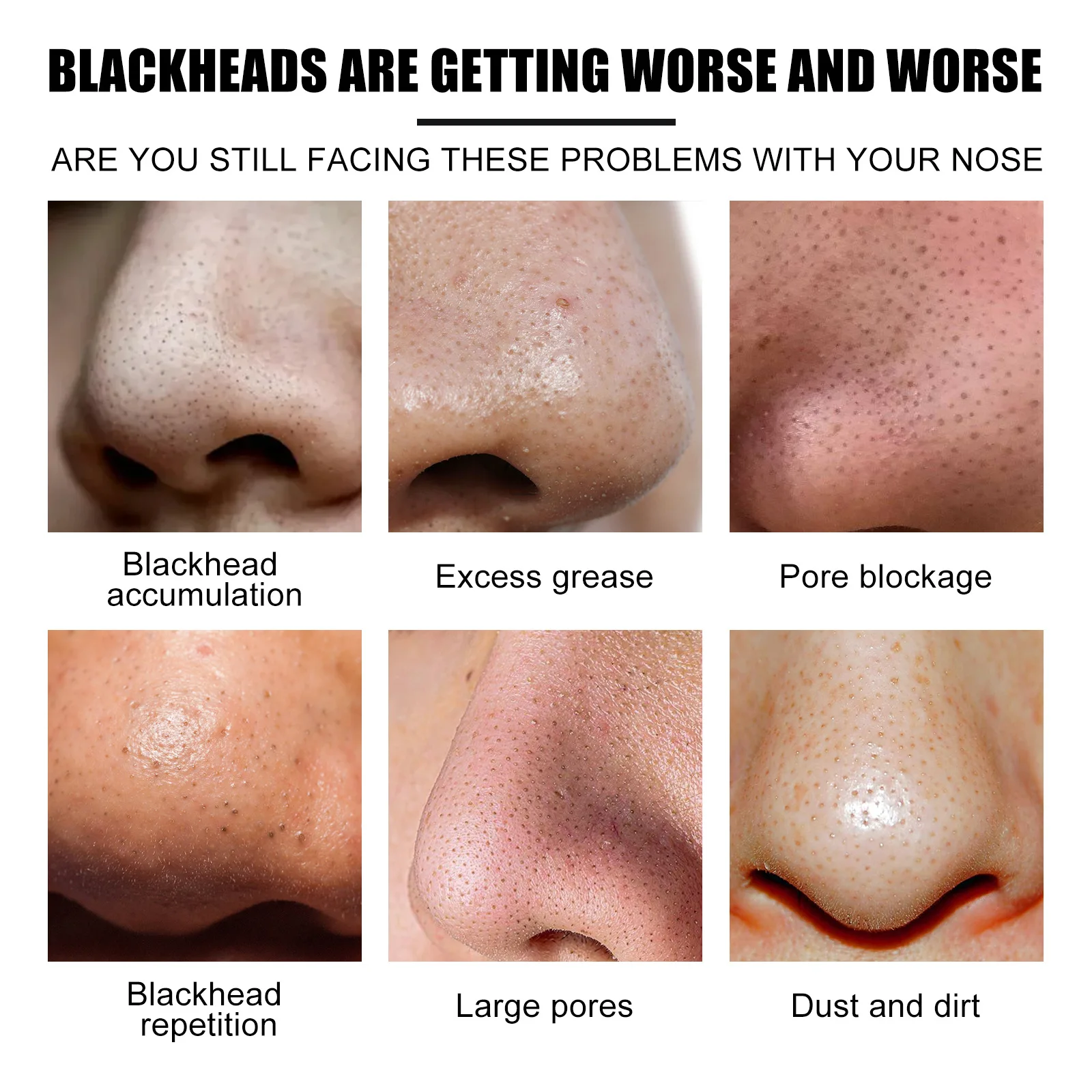 100pcs Nose Blackhead Remover Mask Deep Cleansing Skin Care Shrink Pore Acne Treatment Mask Nose Black dots Pore Clean Strips 4