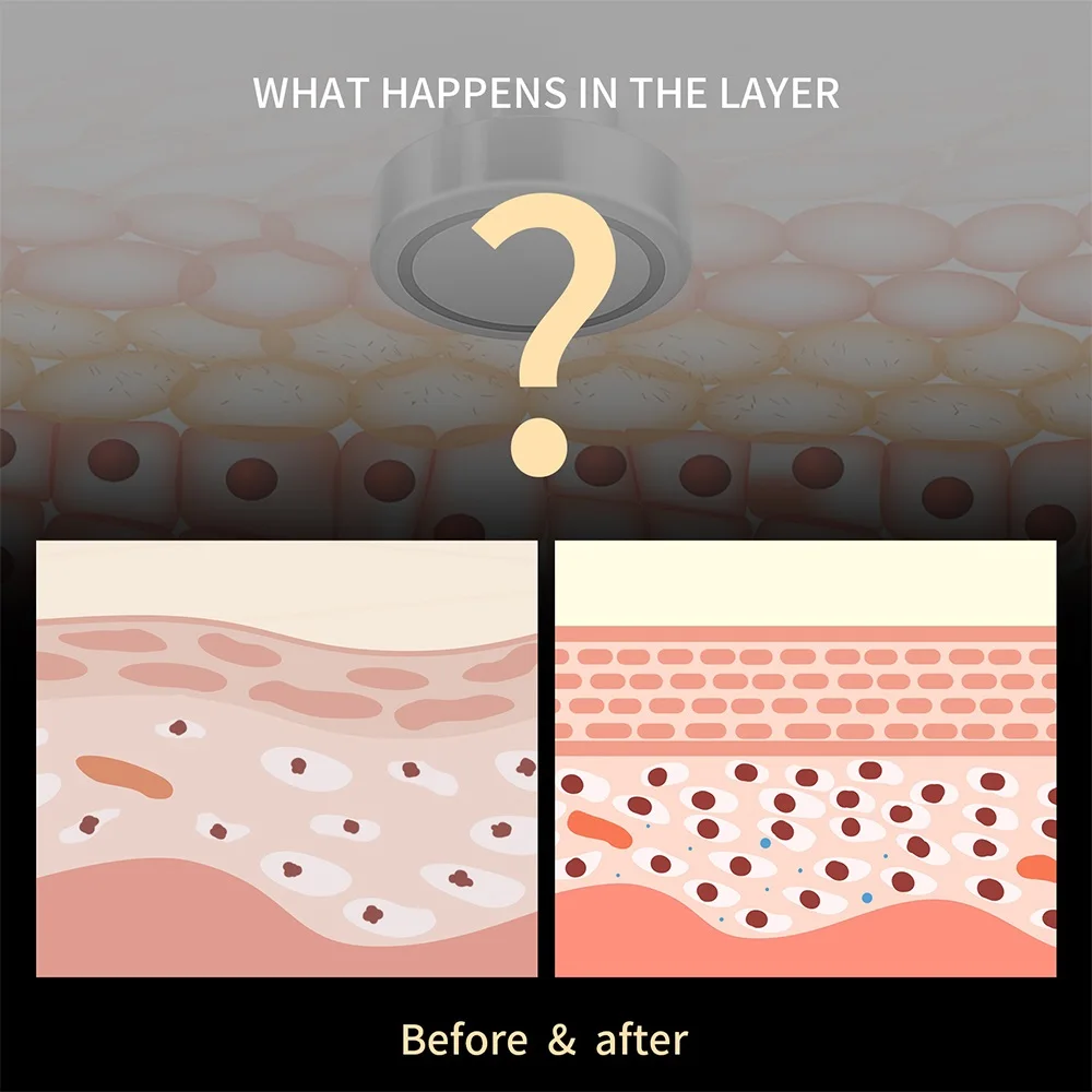 2-IN-1 RF Bipolar Face&Body Lifting Machine 1MHz Radio Frequency Red Light Photon Therapy Anti-Wrinkle Skin Tightening&Slimming