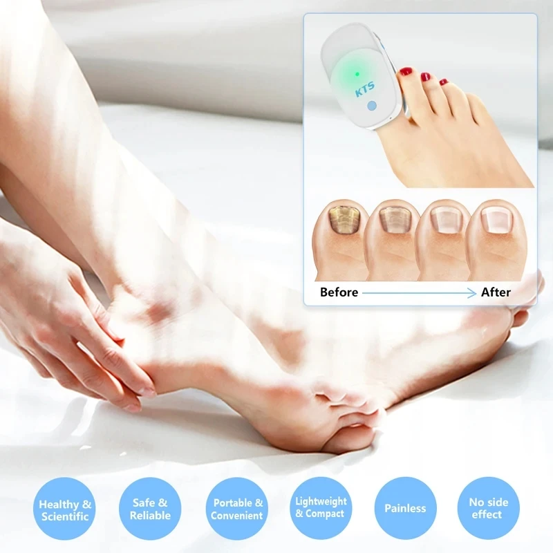 Appareil Laser Traitement Mycose Des Ongles - Luminothérapie LED - Marque QUATTRO - Rechargeable