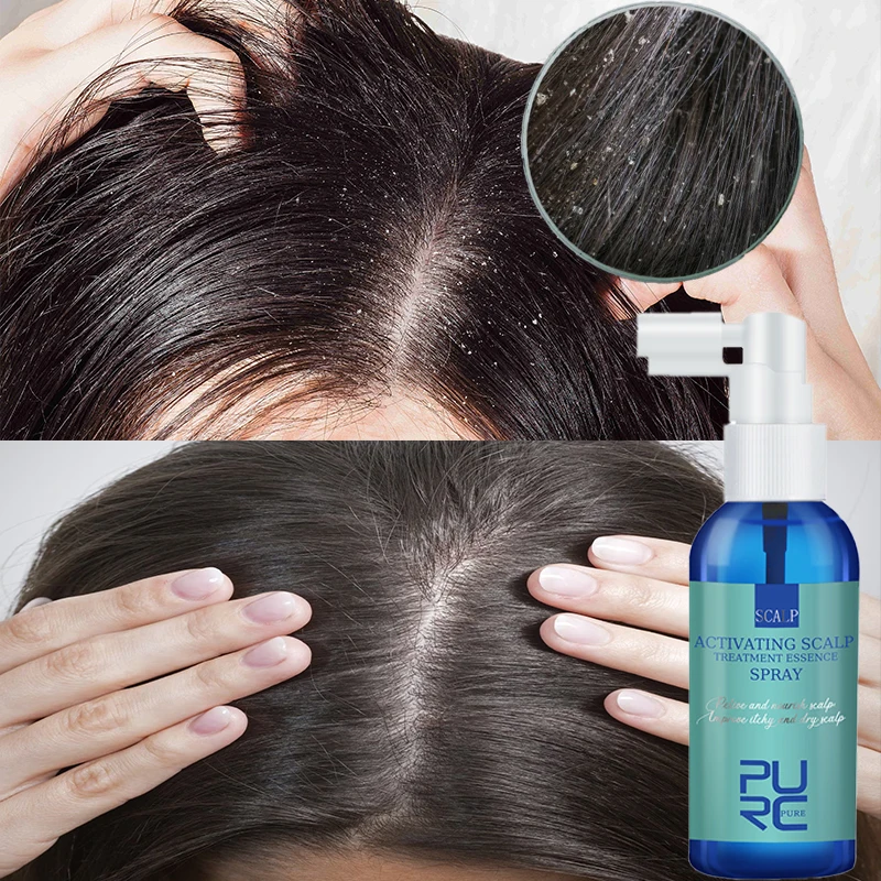 

PURC Anti Dandruff Hair Care Spray Anti Hair Loss Oil Control Itching Essence Repair Damage Frizzy Scalp Treatment Products