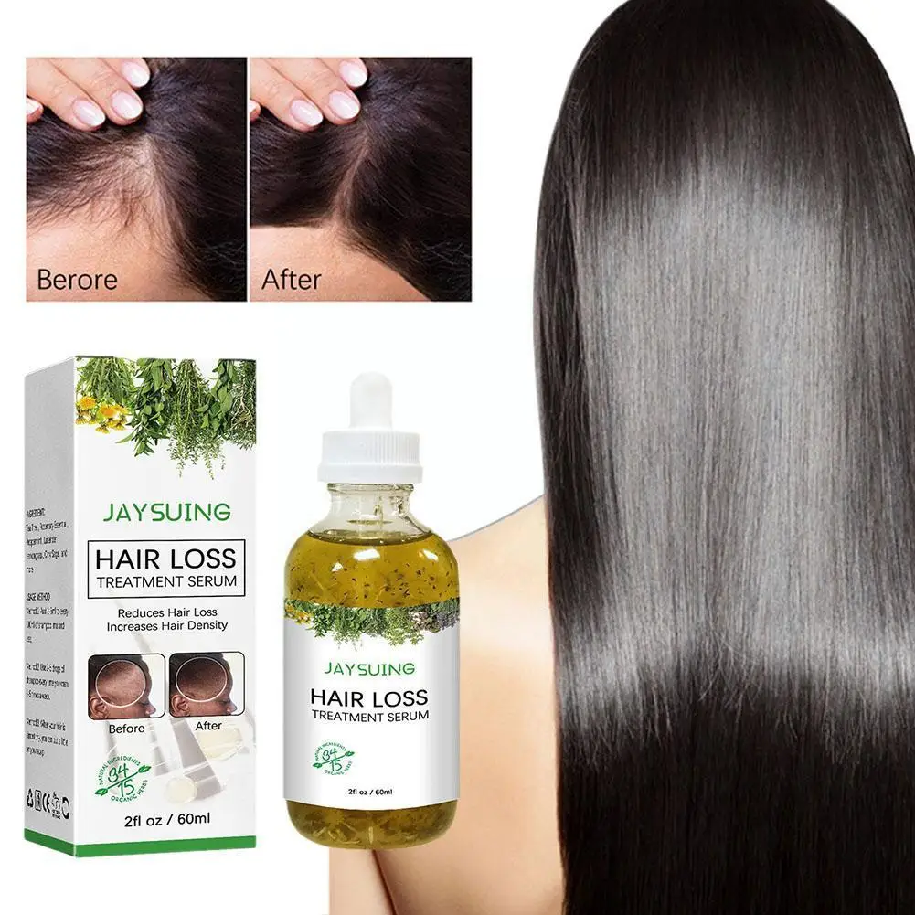 Hair Loss Treatment Shampoo Anti itch Anti Dandruff Root Oil Thicker