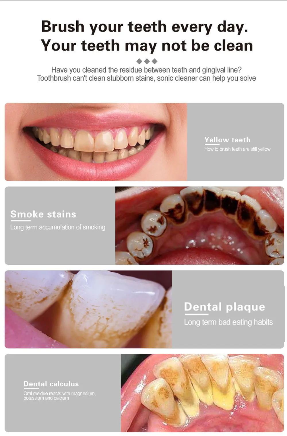 الكهربائية الأسنان مزيل حساب التفاضل والتكامل الأسنان تنظيف جهاز الأسنان نظافة الأسنان تبييض الري إزالة الجير قشارة الأخضر