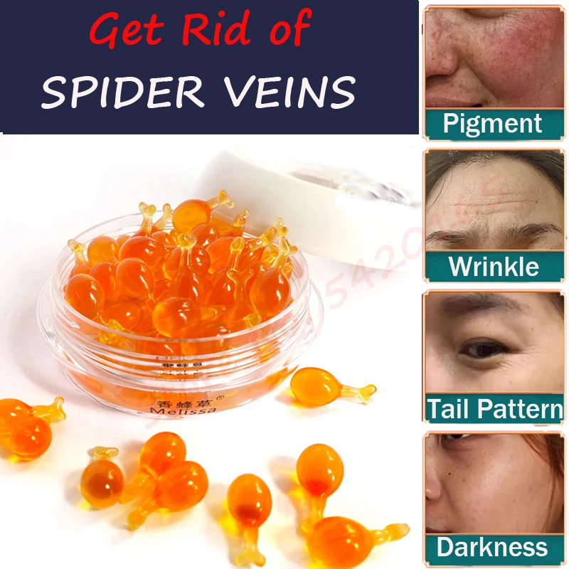 Anti-Spider Vein Essense Face Redness Removal Red Blood Silk Repair Essential Oil Sensitive Skin Face Treatment