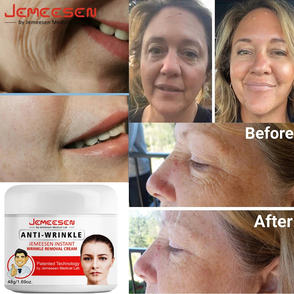 

Крем Jemeesen Retinol против морщин, подтягивающий укрепляющий крем для кожи лица, антивозрастное средство для удаления морщин и шеи, уход за кожей с тонкими линиями, 48 г