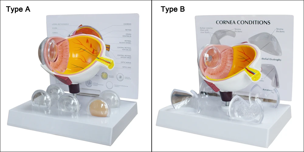 Cornea Eyeball Model Human Eye Demonstration Glaucoma Cataract Anatomy Medical Teaching Tool