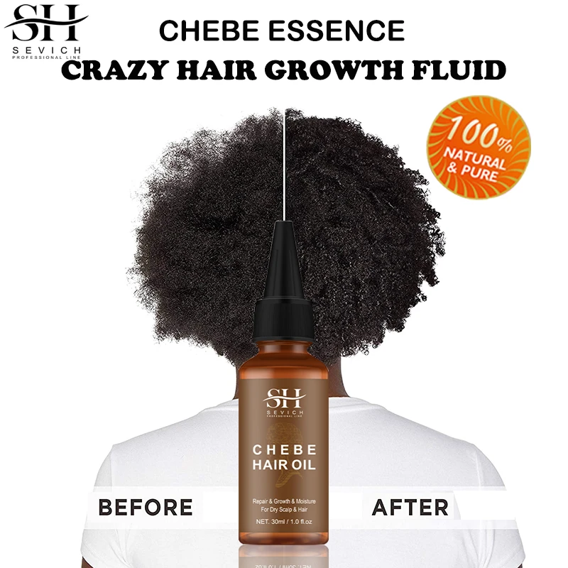 Sevich Hair Growth Product Africa Traction Alopecia Chebe Oil Crazy Thicken  Fast Hair Growing Oil Hair Loss Treatment Hair Care - Hair Loss Product  Series - AliExpress