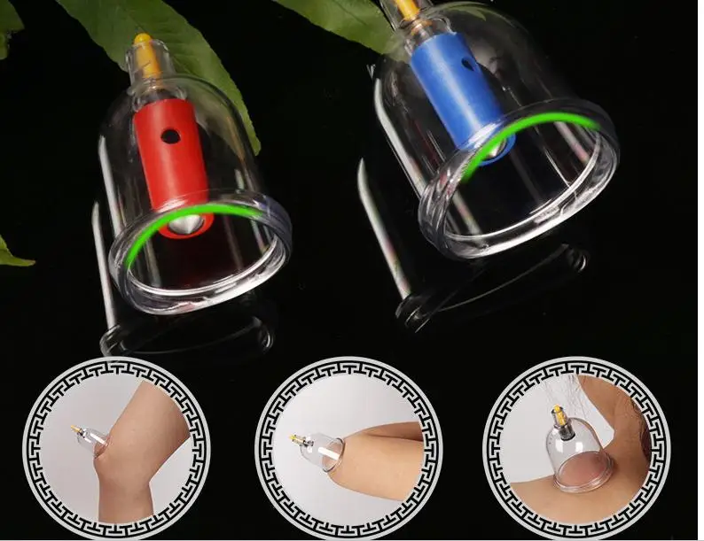32 pieces of Chinese vacuum cupping therapy relaxation massager