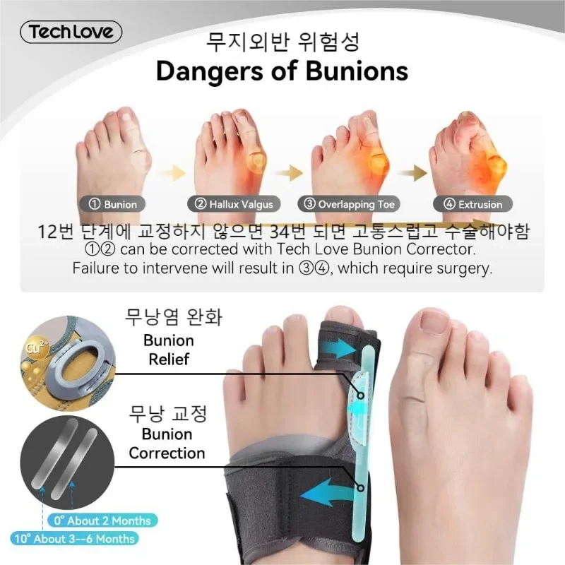 Tech Love Hallux Valgus Corrector Toe Straightener for Toe Alignment and Bunion Pain Relief Foot Care Tools