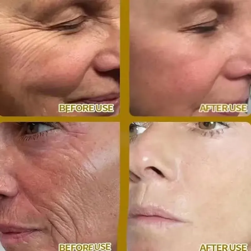 Vitamin C Whitening Serum Face Remove Dark Spots Freckles Fade Melanin Retinol Anti-wrinkle Essence Brightening Korean Skin Care 4