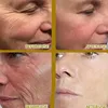 Vitamin C Whitening Serum Face Remove Dark Spots Freckles Fade Melanin Retinol Anti-wrinkle Essence Brightening Korean Skin Care 4