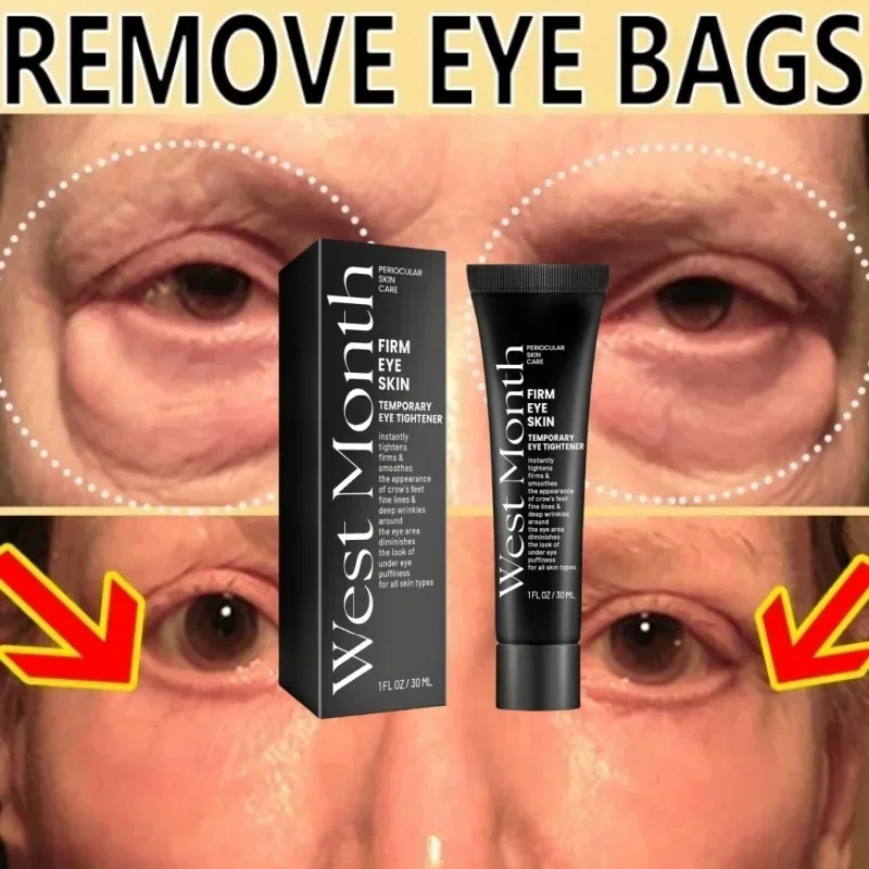 West&Month Eye Cream Removes Dark Circles Tightens Eyes Lifting Firming And Removing Eye Bags