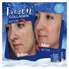 Autocollant Anti-continuité Au Collagène Congelé, Éclaircissant, Anti-acné, Taches De Rousseur, Brillant Pour La Peau, 300 Pièce 2
