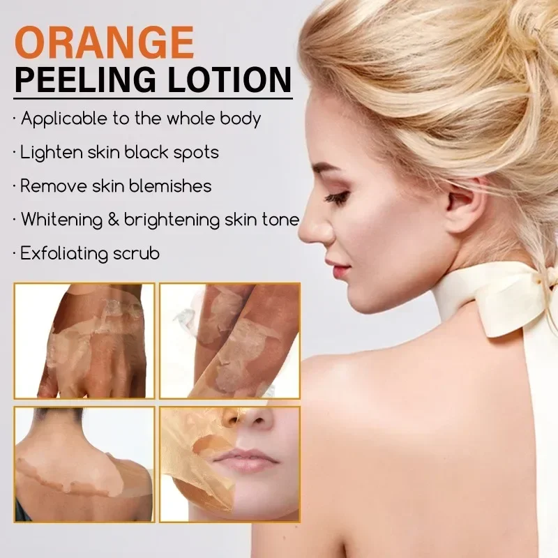 

Sdotter Orange Peeling Oil Body Exfoliation Lotion Bleaching Dark Spots Remove Arm Knee Legs Melanin Brighten Whitening Women Sk