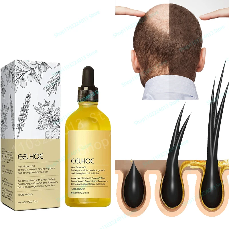 

Hair Growth Products Prevent Hair Loss Essential Oil Fast Growing Anti-Drying Scalp Treatment Repair Beauty Health for Men Women