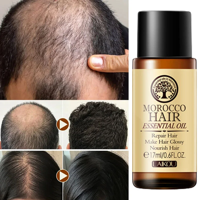 

Hair Growth Oil Serum Fast Regrowth Products For Man Women