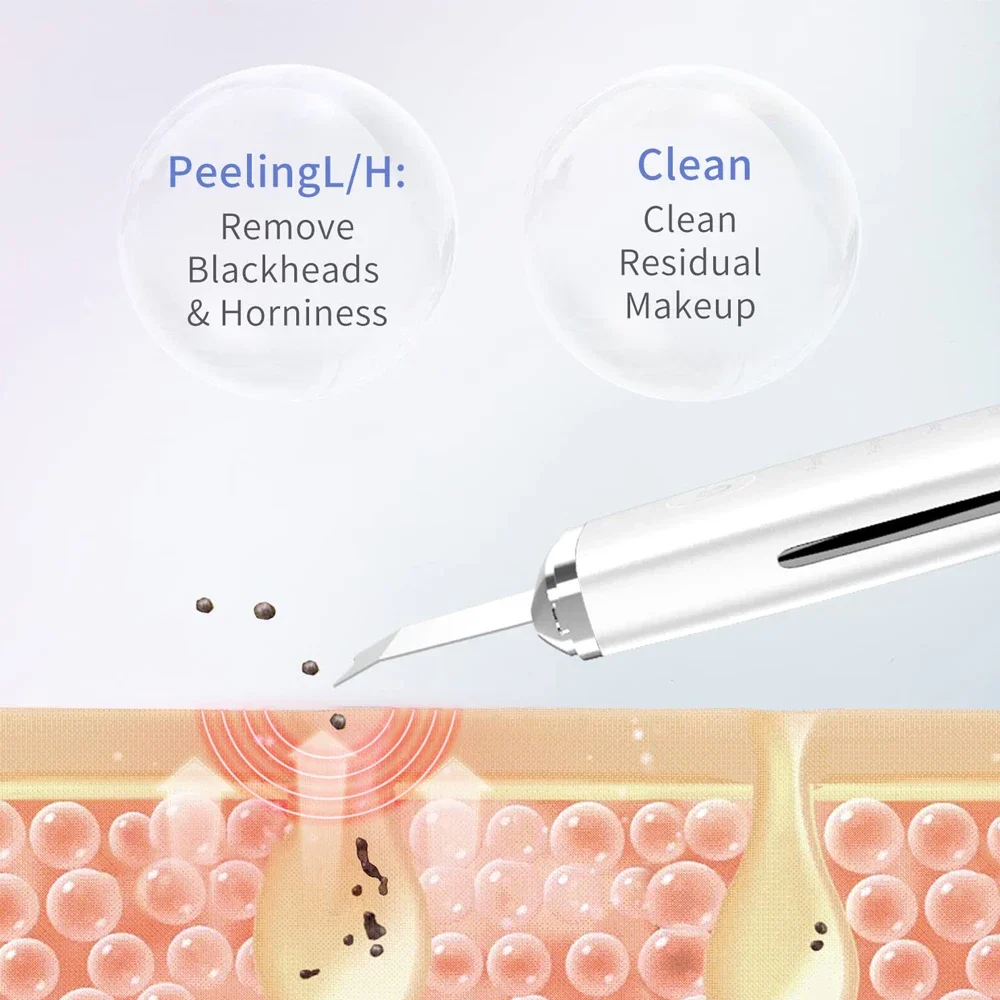 Facial Scrubber Electric Skin Scrubber Peeling Blackhead Remover Deep Face Cleaning Lifting Ion Acne Pore Cleaner Facial Spatula Shovel Cleanser