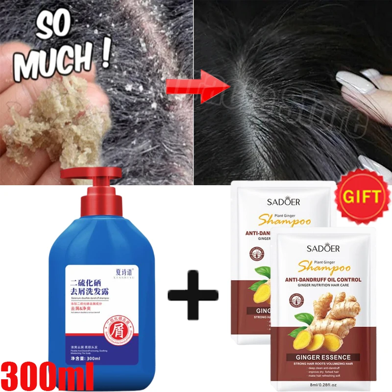 

Fast Anti Dandruff Hair Treatment Shampoo Oil-Control Itching Repair Scalp Mite Remover Cleaning Products Antipruritic Hair Care