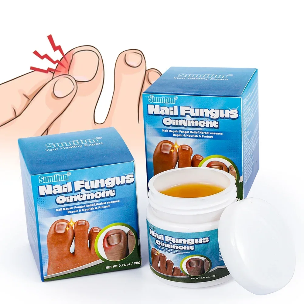 Nail Fungus Remover Treatment Cream Anti Infection Onychomycosis Paronychia Repair Gel Toe Nail Fungal Removal Hand Foot Care Products