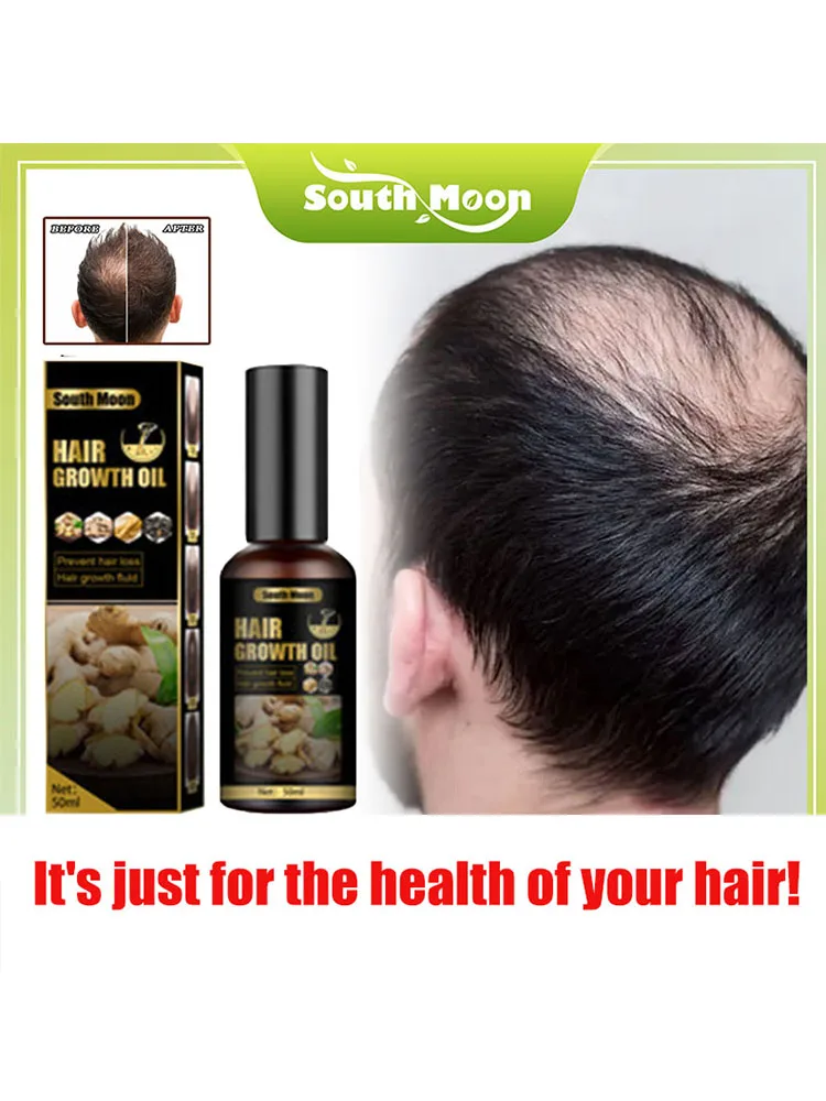 

To solve the problem of hair loss. Anti hair loss spray anti hair loss hair nutrition growth agent essence promotes hair growth